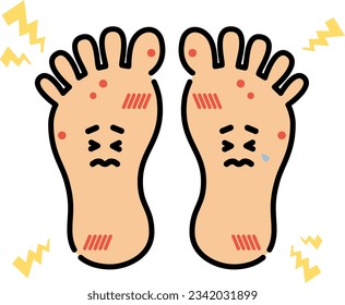 Clip art of feet characters with blisters