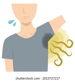 Clip Art Of A Man Who Suffers From Underarm Sweat And Odor