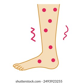 Clip art of red swollen leg bitten by insect