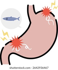 clip-art de um estômago infectado com anisakis