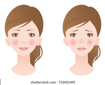 clogged pores and clean pores on nose of female face. before and after skin care treatment