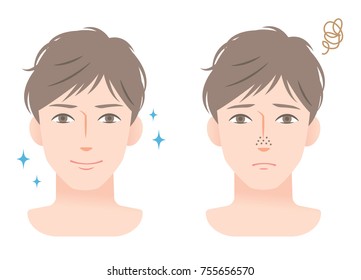 clogged pores and clean pores on nose of men’s face. before and after men’s skin care