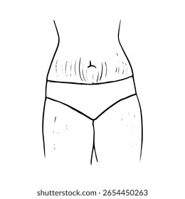 close up de estrias femininas no estômago e coxas - desenho à mão linha arte