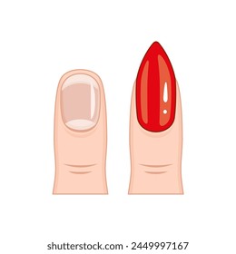 A close up of a fingernail with a red tip. The nail is painted with a red polish. 