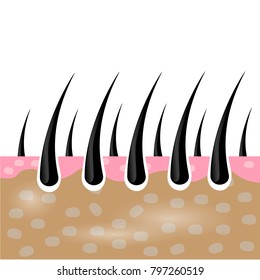 Close up hair and scalp vector illustration.concept of Treatment and maintenance of the hair.