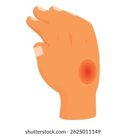 Close up of a hand experiencing skin irritation, possibly indicating eczema or a rash