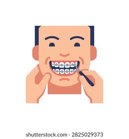 Close up of a man smiling with metal braces on his teeth, cleaning them with a small brush.