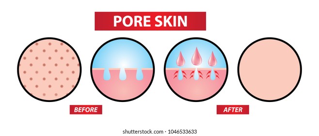 Close Open Pores Skin Before And After Vector Illustration