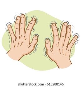 Close part of the body, pair of hands shaking symptoms of, Parkinson's disease, cold or fear, Caucasian. Ideal for educational and institutional and medical materials