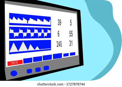 Close up of the screen of ventilator monitoring in operating room. Mechanically ventilated patient in hospital image monitor of computer device.
