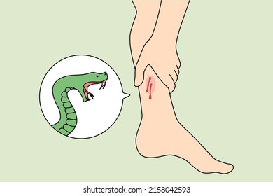 Close Up Of Snake Bite Person Leg Need Emergency Medical Help. Poisonous Serpent Snap Outdoors. First Aid And Healthcare Concept. Flat Vector Illustration. 