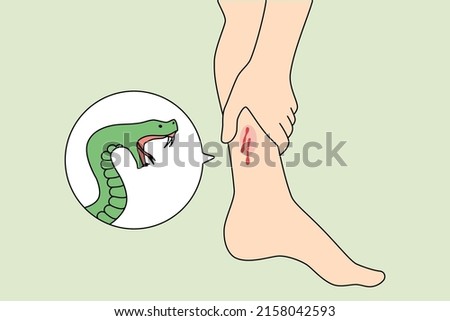 Close up of snake bite person leg need emergency medical help. Poisonous serpent snap outdoors. First aid and healthcare concept. Flat vector illustration. 
