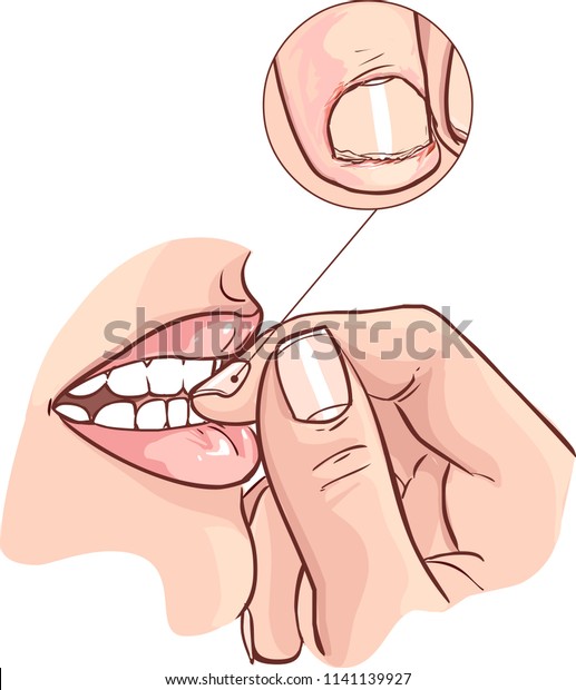 Close up view on the\
woman biting nails 