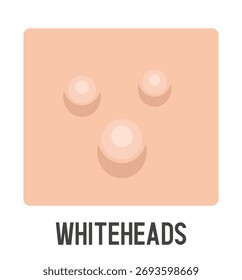 Closed comedone vector illustration. Whitehead. Acne type. Vector flat clipart