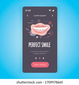 closeup beautiful woman smiling perfect smile dental care and whitening teeth smartphone screen mobile app copy space vector illustration