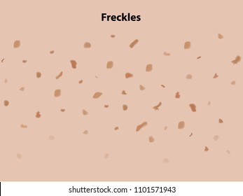 Closeup Freckle Skin Texture Vector Illustration