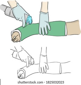 close-up hand cutting plaster cast at leg and foot patient to immobilize after fracture injury vector illustration sketch doodle hand drawn with black lines isolated on white background