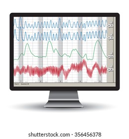 Closeup Of A Polygraph Test Chart. Vector Illustration