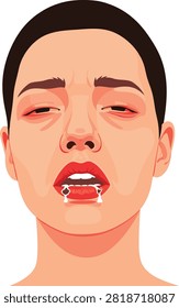 Close-up of a sick person with red, irritated eyes and drooling mouth, ideal for health awareness posters, illness symptom infographics, medical education materials, and public safety campaigns