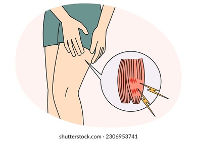 Closeup of sportsman stretch leg muscle suffer form pain. Unwell person having injury or cramp from sports activity. Athlete trauma and first aid concept. Vector illustration.