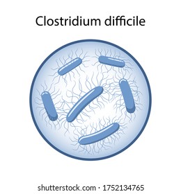 Clostridium difficile in magnifying glass. The causative agent of intestinal infection. Microbiology. Vector illustration in flat style isolated over white background