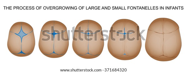 La Fermeture De La Fontanelle Du Image Vectorielle De Stock Libre De Droits La Fermeture De La Fontanelle Du Image Vectorielle De Stock Libre De Droits