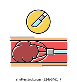 Farbensymbol zur Entfernung von Gerinnseln, Vektorgrafik. Blutgerinnungszeichen. einzelne Symbolillustration