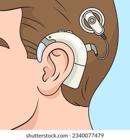 Cochlear implant on human head diagram schematic vector illustration. Medical science educational illustration