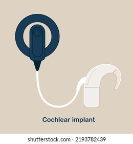 Cochlear Implant Vector illustration. Hearing therapy concept. World Deaf Day in last Sunday of September.