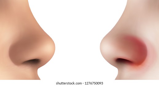 cold, flu, allergies, sick nose vector template for treating symptoms