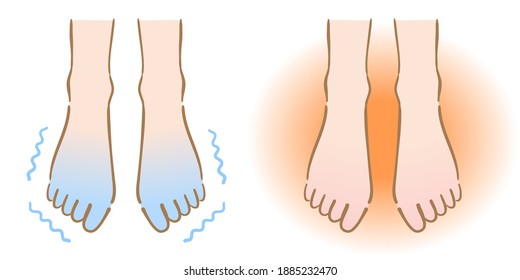 Cold And Warm Feet.Human Body Part. Health Care Concept