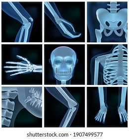 Collage Of Many X-rays Photos. EPS10 Vector