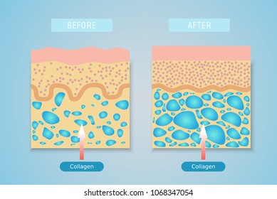 Collagen ,Protection Skin Vector