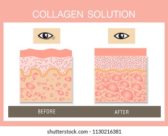 Collagen ,Protection Skin vector