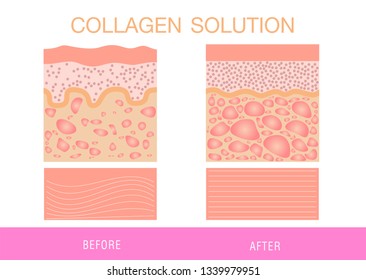 Colágeno, vector de protección de la piel