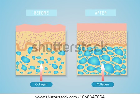 Collagen ,Protection Skin vector