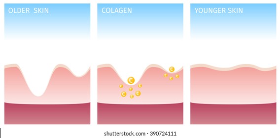 collagen and skin , vector , yellow collagen