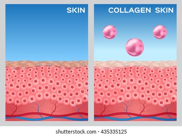 collagen turn a skin to white vector graphic , cosmetic 