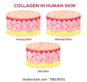 collagen in younger skin and aging vector version