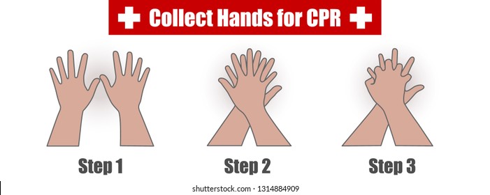 Collect Hands Step For Chest Compressions Cardiopulmonary Resuscitation (CPR) Process In First Aids Rescue On Unconscious Person - Infographic Flat Design