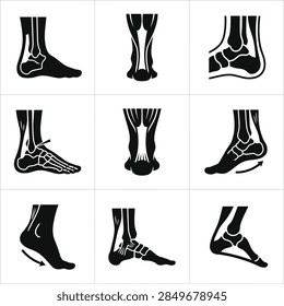 Collection of black and white vector illustrations showing the skeletal structure of the human foot and ankle from different angles.
