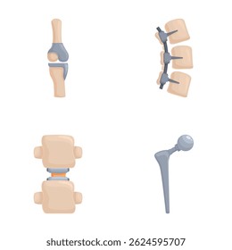 Colección de implantes ortopédicos detallados, mostrando prótesis de rodilla y columna vertebral
