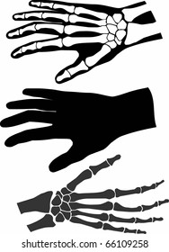 A collection of human hands and bones