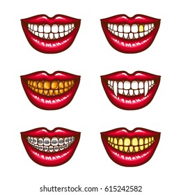 A collection of pop art icons of red female lips - smiling, with vampire fangs, with metal dental crowns, with braces. Badges, stickers, design elements, prints for T-shirts