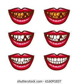 A collection of pop art icons of red female lips - smiling, with missing teeth, with spoiled teeth. Badges, stickers, design elements, prints for T-shirts