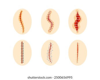 Collection of round icons representing various sutured wounds in different configurations, showing the process of surgical suture healing.