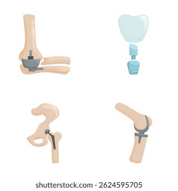 Collection of stylized illustrations representing various joint prostheses