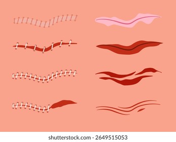 Una colección de Ilustraciones vectoriales que representan varios tipos de heridas en la piel humana, incluyendo rasguños, raspaduras y abrasiones