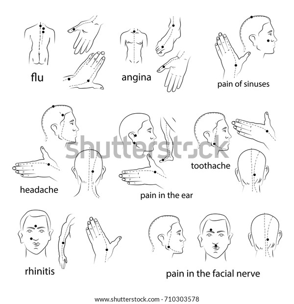 Collection Vector Schemes Acupuncture Points That Stock Vector (Royalty ...