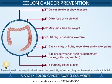 Colon cancer disease prevention infographic vector illustration. Protection, treatment, diagnosis, and symptoms concept. Flat style medical template. Hand-drawn awareness month, and health design. 